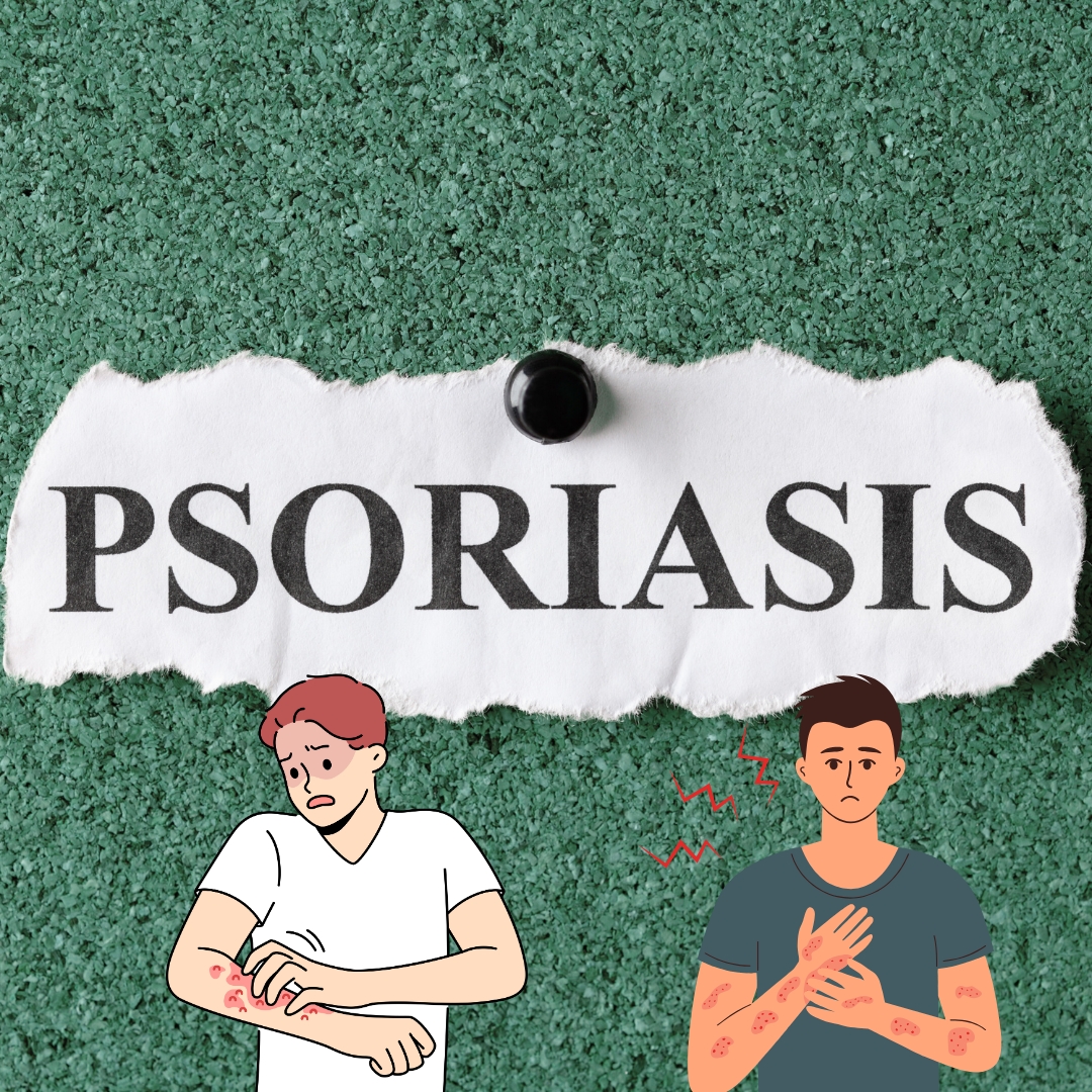 الصدفية | psoriasis